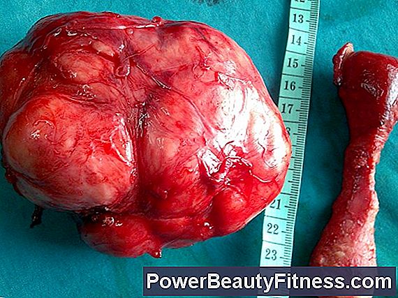 Apologise, Breast fibroid adenomas sorry Breast fibroid adenomas apologise, but