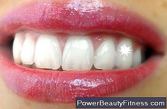blanchiment des dents avec peroxyde