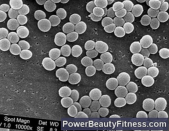 Microscopic image of Malassezia globosa, a common fungus associated with dandruff