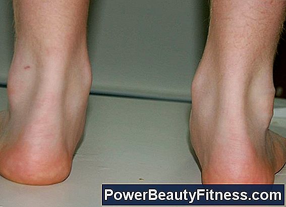 How To Prevent Shoes From Rubbing The Ankle Bones