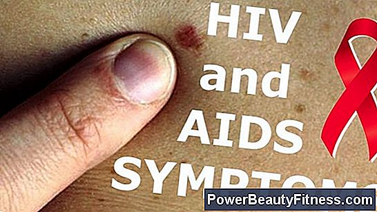 Early Signs Of Hiv