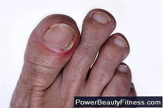 Problems With Curved Toenails