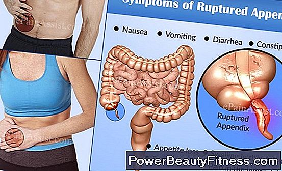 What Are The Causes Of Polyps In The Stomach?