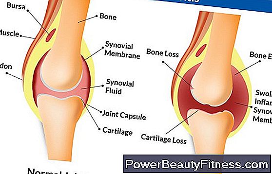 Causes Of One Leg Swelling With Pain
