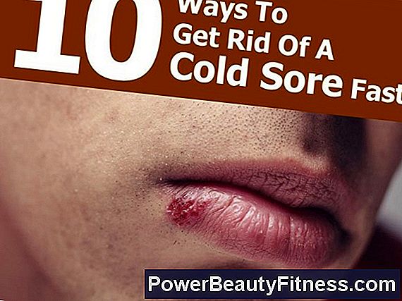 How To Make Blisters From Cold Sores Disappear Quickly