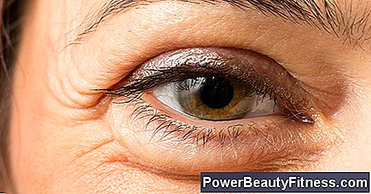 What Are The Causes Of Swollen Bags Under The Eyes?