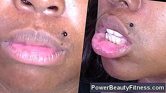 Lip Discoloration And Smoking