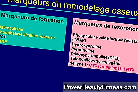 Élévation De La Phosphatase Alcaline Et Le Cancer